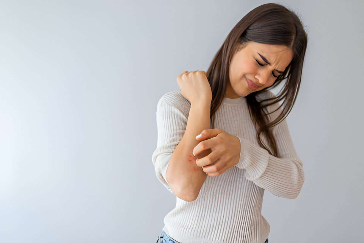 Skin Allergies: Causes, Symptoms & Ayurvedic Treatment