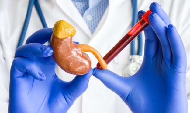 Control Creatinine