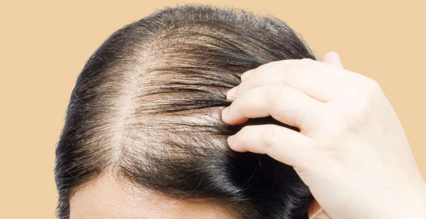Thinning Hair in Women & Hair Loss: Advice and Reasons – Equi Botanics