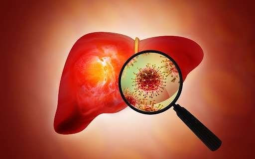 Best Ayurvedic Treatment for Hepatitis: Causes, Symptoms, Home Remedies & Herbal Medicine