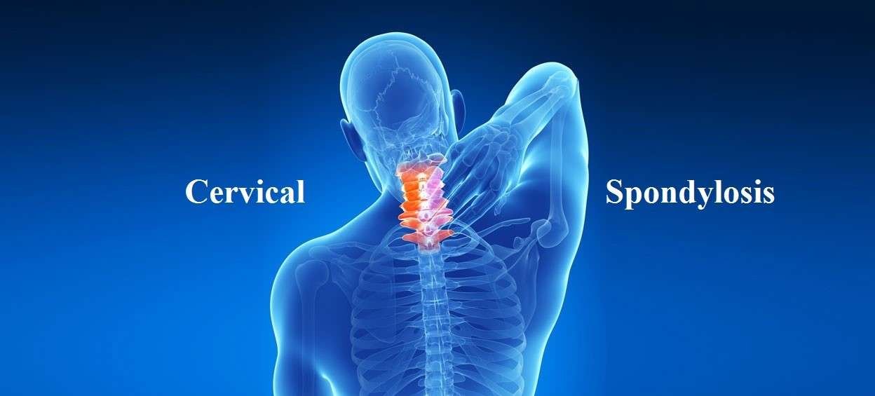 Best Ayurvedic Treatment for Cervical Spondylosis: Causes, Symptoms & Remedies