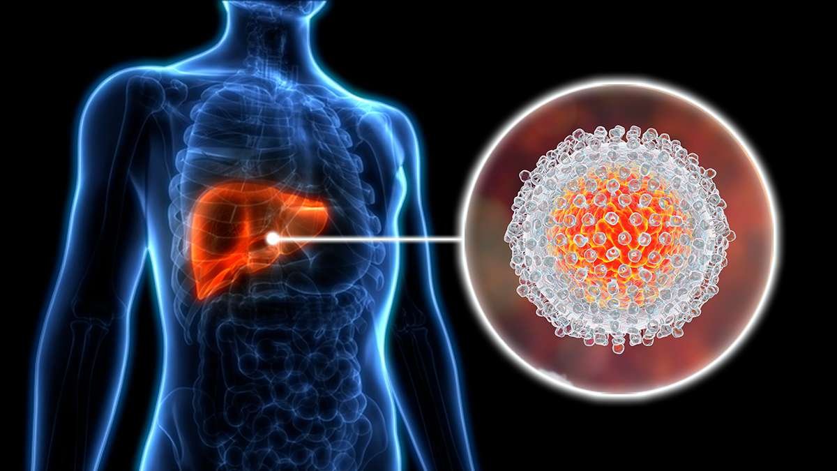 Hepatitis A | Hepatitis A | CDC