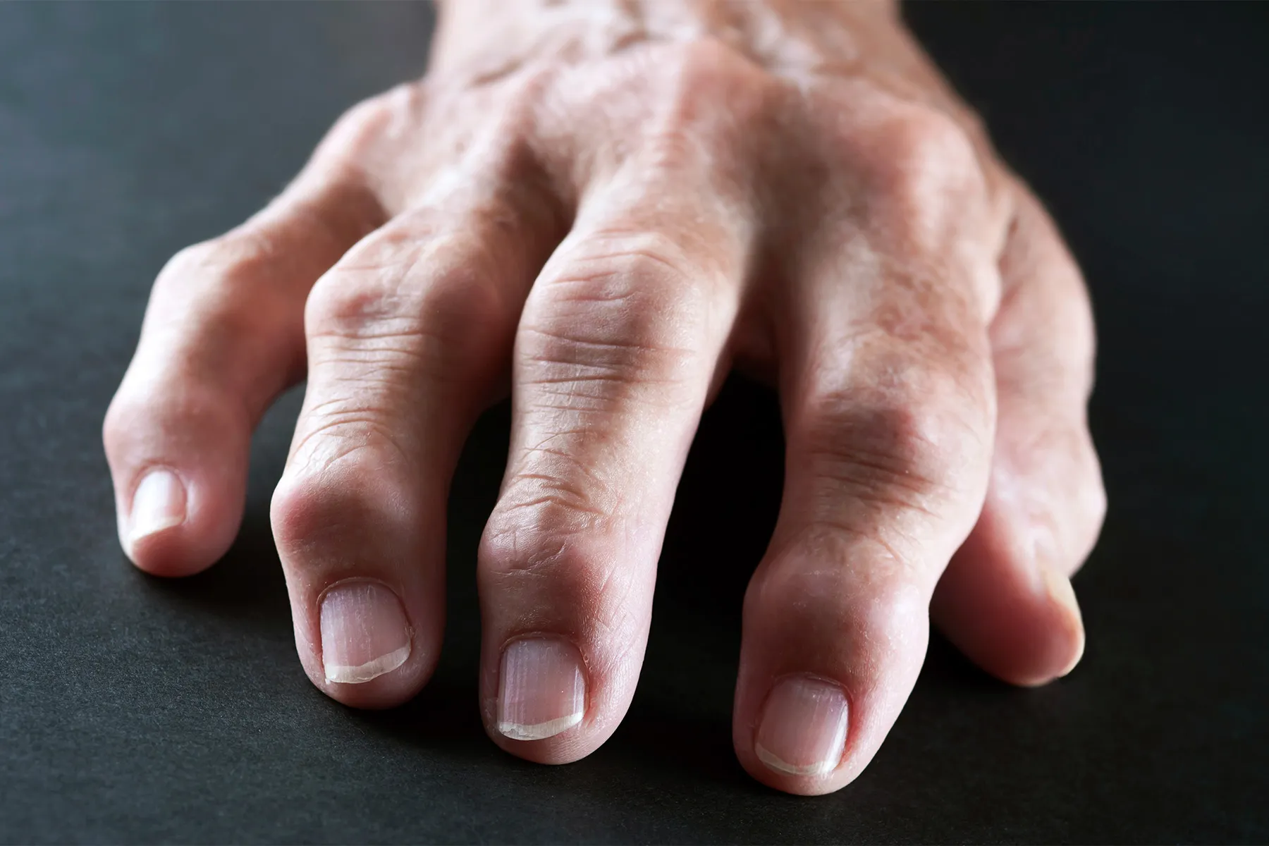 Best Ayurvedic Pain Oil for Rheumatoid Arthritis