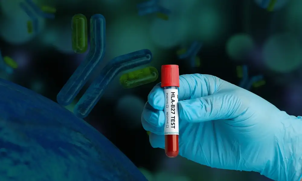 10 Signs of HLA-B27 You Should Not Ignore