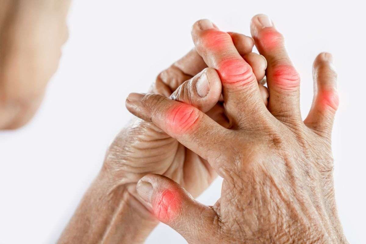Rheumatoid Arthritis: Causes, Symptoms & Ayurvedic Consultation